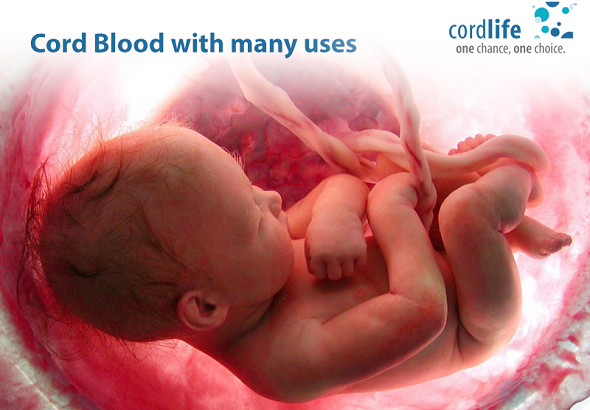 Does Storing of Umbilical Cord Beneficial?