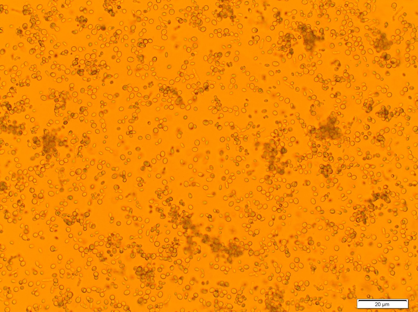 Fantastic Fungi Featurette Specimen 11 Yeast