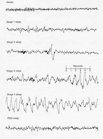 Things We Don't Know: How do we fall asleep?