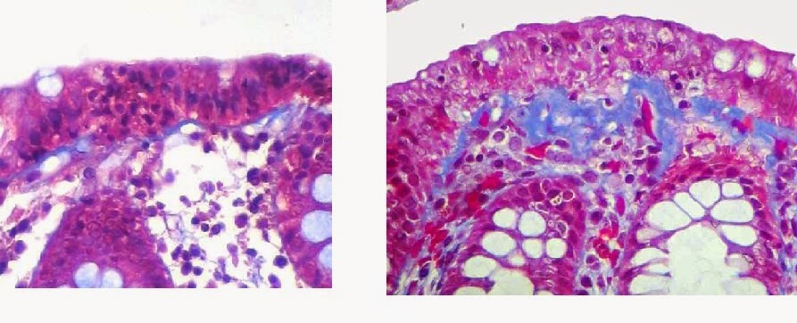 GASTROINTESTINAL AND LIVER HISTOLOGY PATHOLOGY ATLAS: COLON ...