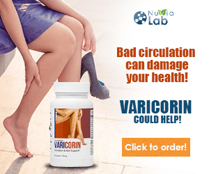 Varicorin - Beautiful Legs, Beautiful You