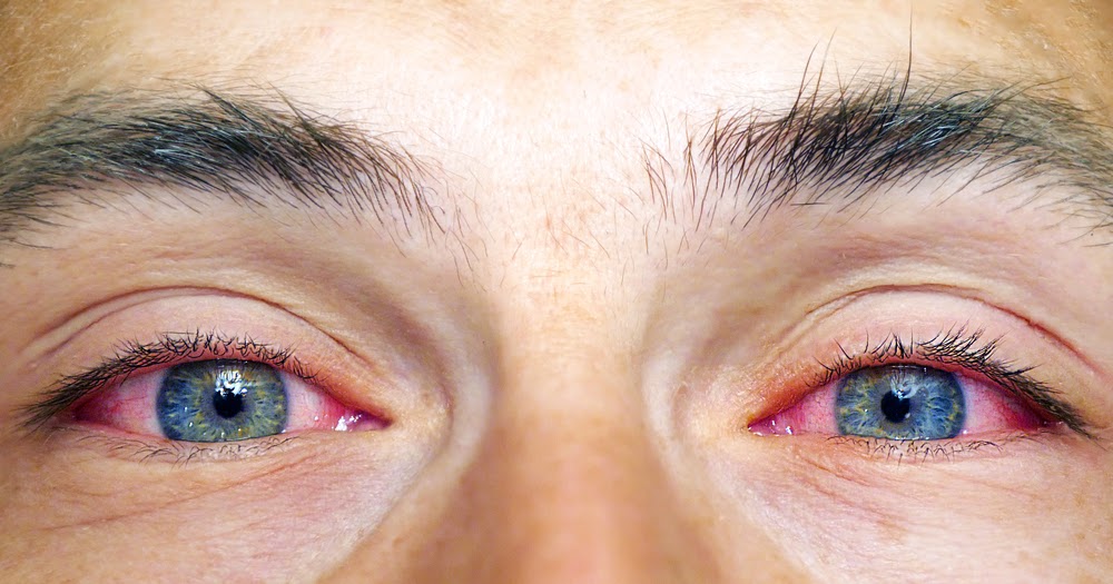 Free Health Tips Good Nutrition Healthy Diet Child What's causing