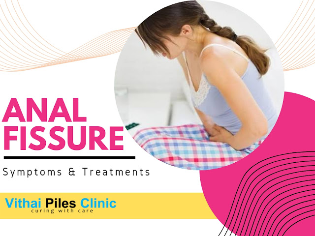 anal fissure, Symptoms of Fissure, fissure treatment in Pune, best fissure doctor in Pune, laser treatment for fissure in Pune, laser treatment for fissure PCMC, ayurvedic treatment for fissure in Pune, Vithai Piles Clinic