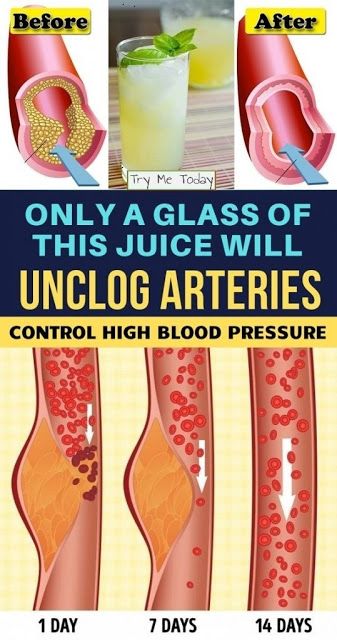 Take 4 Tablespoons Of This Every Morning And Say Goodbye To Clogged Arteries, High Blood Pressure, And Bad Cholesterol! 