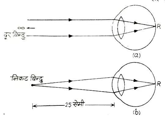 मानव नेत्र (Human Eye in hindi):नेत्र की संरचना,भाग,नेत्र से देखना