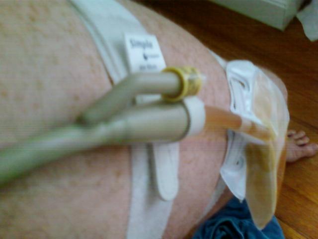 Bag Diaper Images Bag Catheter