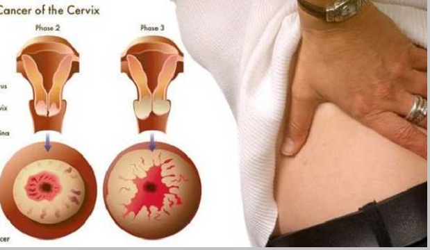 Penyakit Pada Sistem Reproduksi Manusia Beserta Gejala Dan Cara Pencegahannya Pustakapengetahuan Com