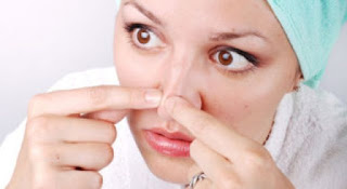 10 Cara Untuk Menghilangkan Komedo Di Hidung Dan Bibir Termudah