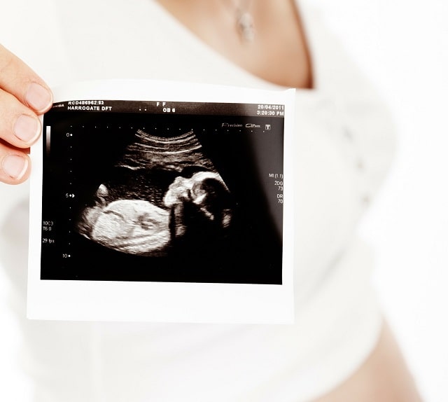 maternal-fetal medicine specialist pregnancy ultrasound doctor maternal-fetal medicine specialist pregnancy ultrasound doctor