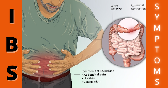 Irritable Bowel Syndrome - symptoms