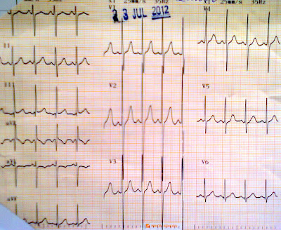 CARDIOLOGÍA: Casos Clínicos