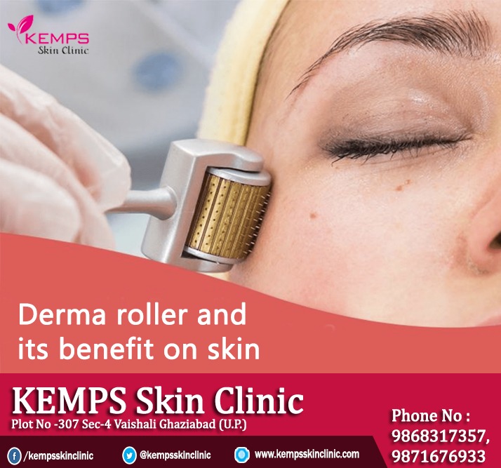 What is Derma roller and what is its benefit on skin? KEMPS Skin Clinic