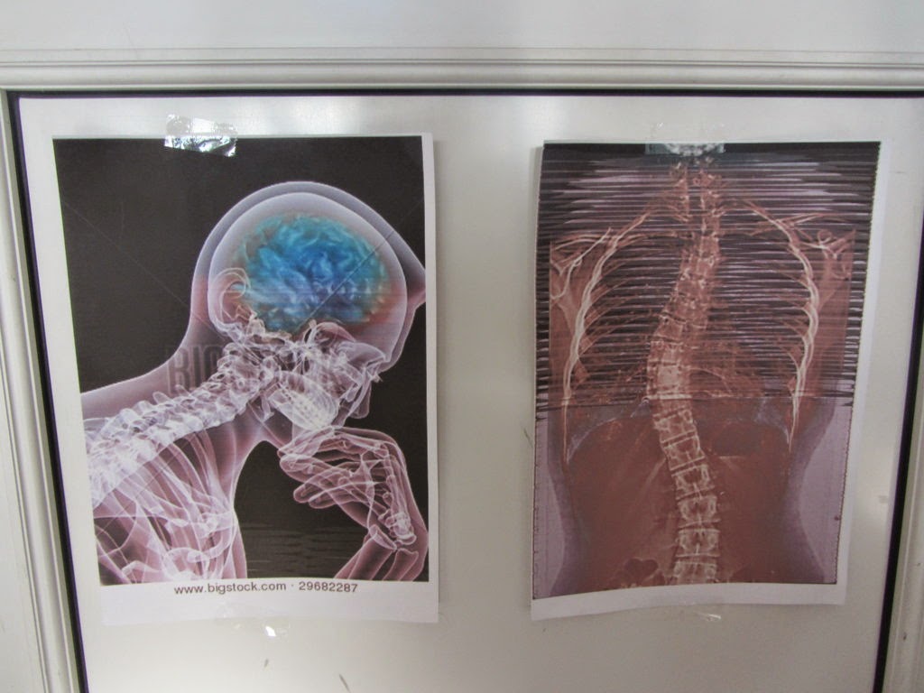 Como ver crecer la hierba: EL ESQUELETO