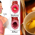 Remove Mucus and Phlegm Naturally in Your Chest and Throat Fast