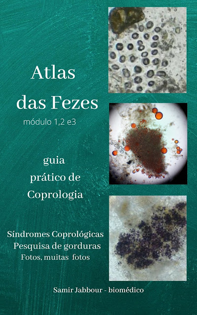 Atlas Das Fezes Guia Pratico De Coprologia