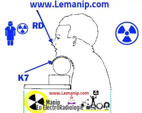 Incidence ORTHOPANTOMOGRAPHIE MAXILLO-FACIALE