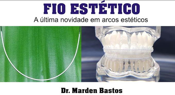 FIO ESTÉTICO: A última novidade em arcos estéticos - Dr. Marden Bastos