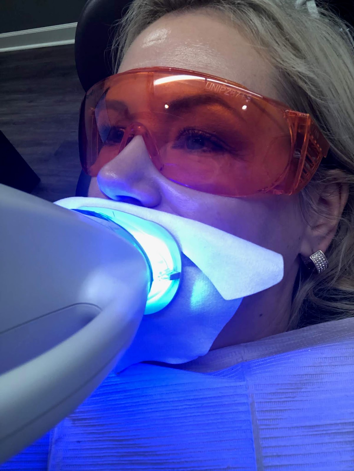 My Philips ZOOM! Teeth Whitening experience with before and after!