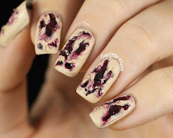 nail bite serious pretty dead torn walking flesh