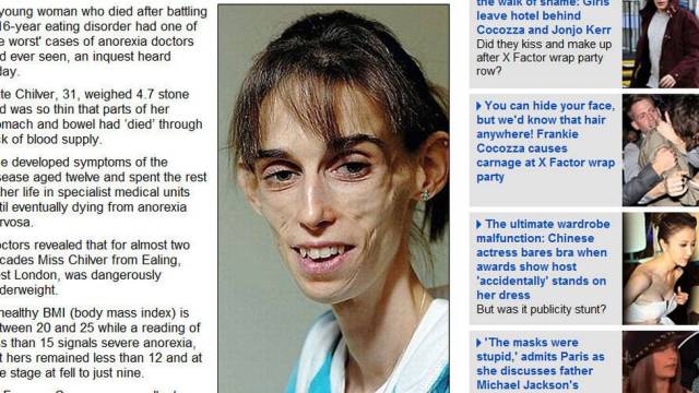 A PROVÍNCIA: VÍTIMA DE ANOREXIA MORRE APÓS 16 ANOS DE SOFRIMENTO