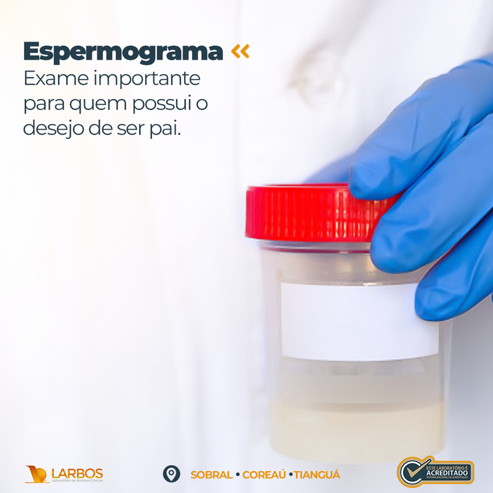 CAMOCIM ONLINE ESPERMOGRAMA EXAME FEITO PELO LARBOS CAMOCIM CAMOCIM ONLINE ESPERMOGRAMA EXAME FEITO PELO LARBOS CAMOCIM