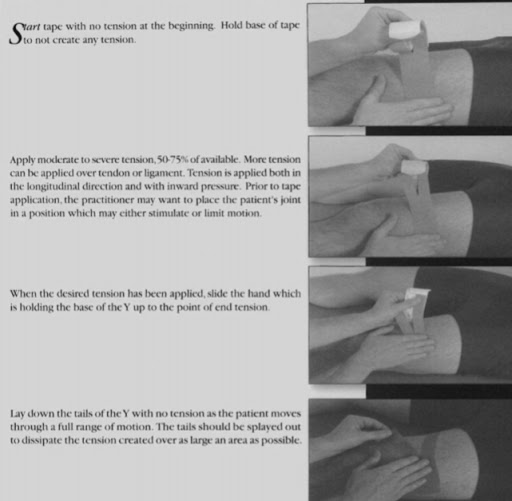 Corrective Application Techniques With K Tape