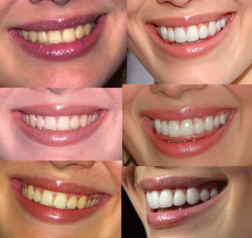 DEL RIO FAMILY DENTAL BLEACHING & BRACES