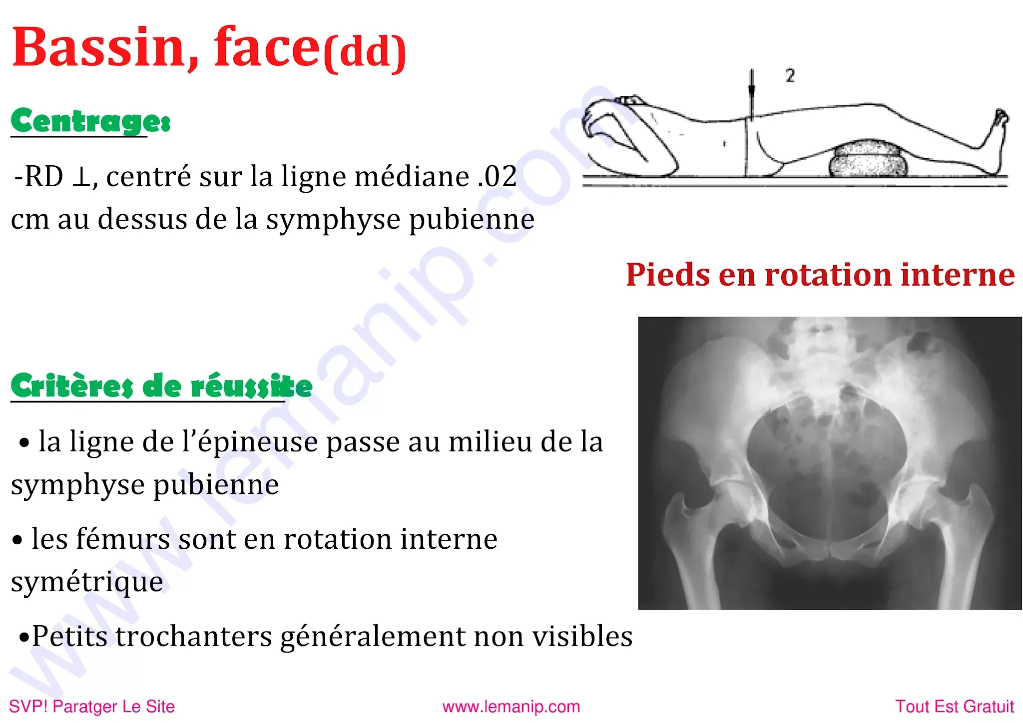 Bassin de face