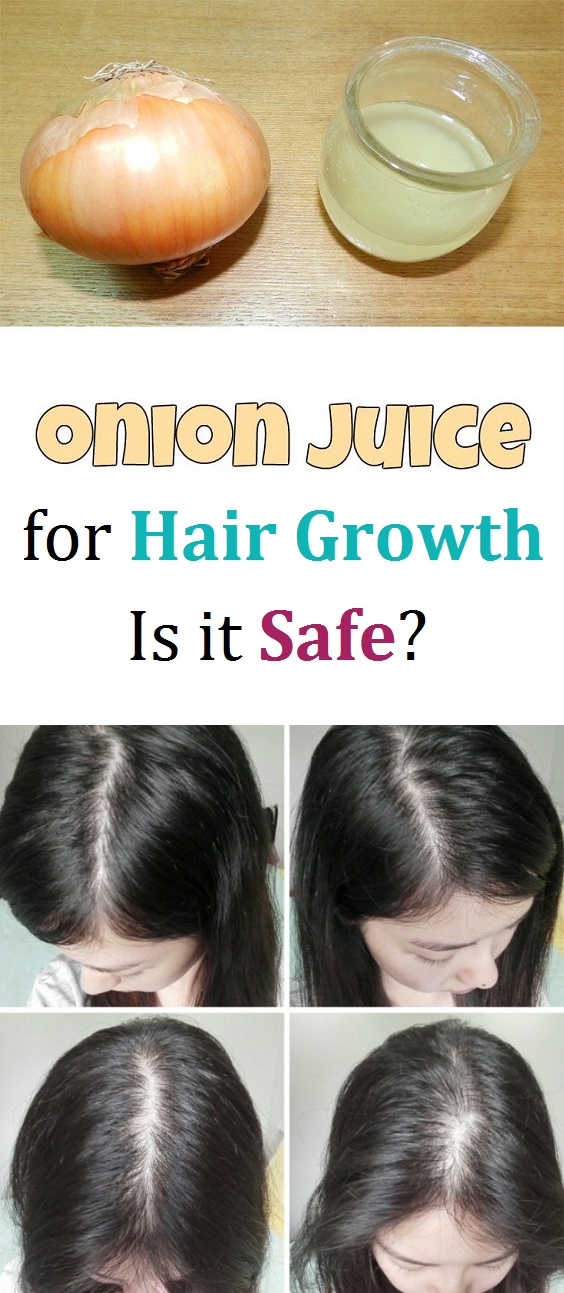 Onion Juice for Hair Growth Is it Safe? Beautypro Club