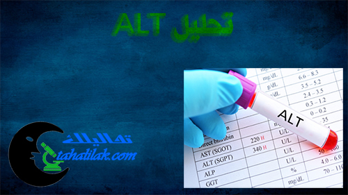 التحليل البديل ما هو التحليل البديل؟