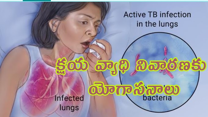yoga for tuberculosis - క్షయ వ్యాధి నివారణకై యోగాసనాలు