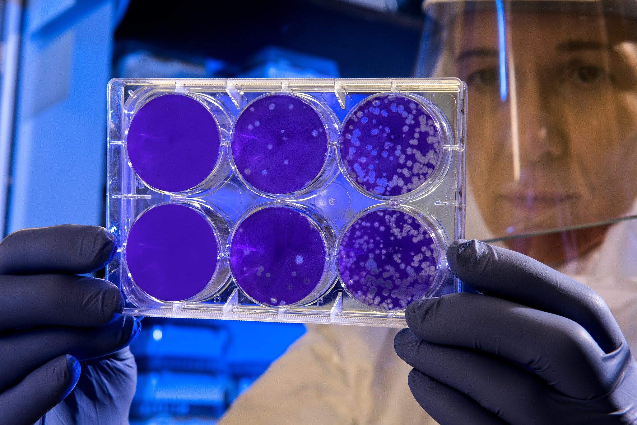 Black, White, And Yellow Fungus Causes, Symptoms And Precautions