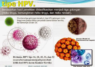 Virus HPV Kutil Kelamin Bisa Menyebabkan Kanker Serviks