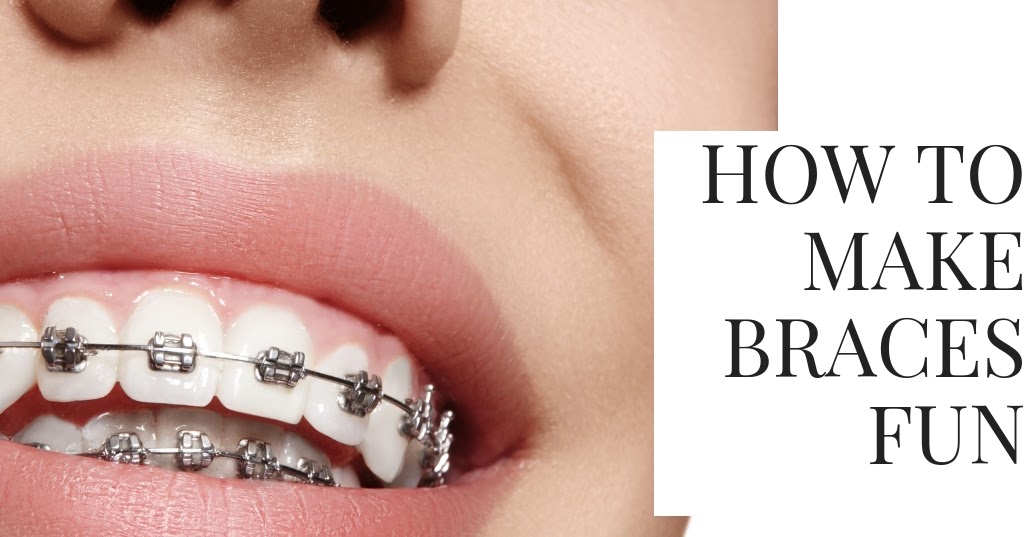 How to Make Braces Fun