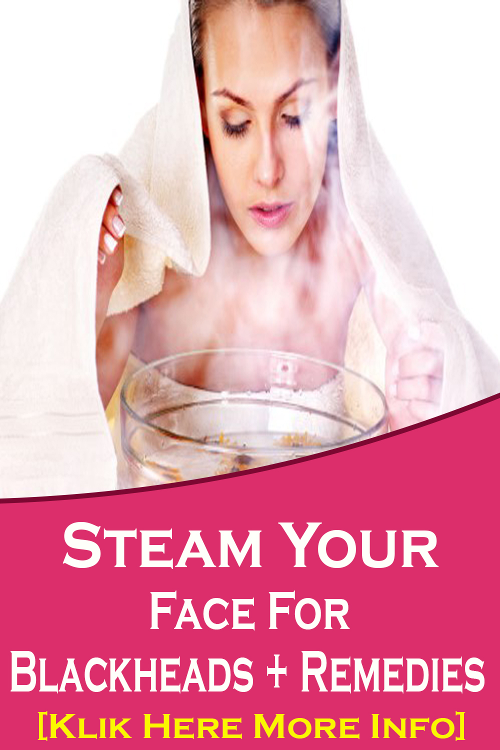 How To Steam Face To Remove Blackheads exstremboard