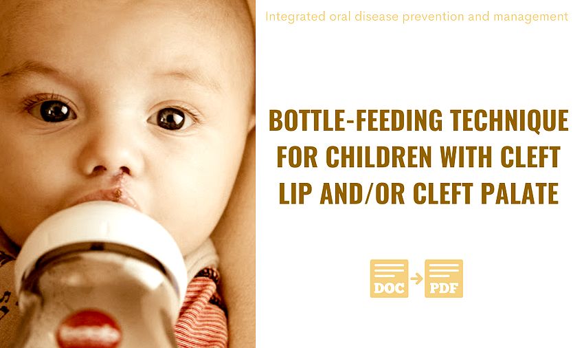 PDF Bottlefeeding technique for children with cleft lip and/or cleft palate