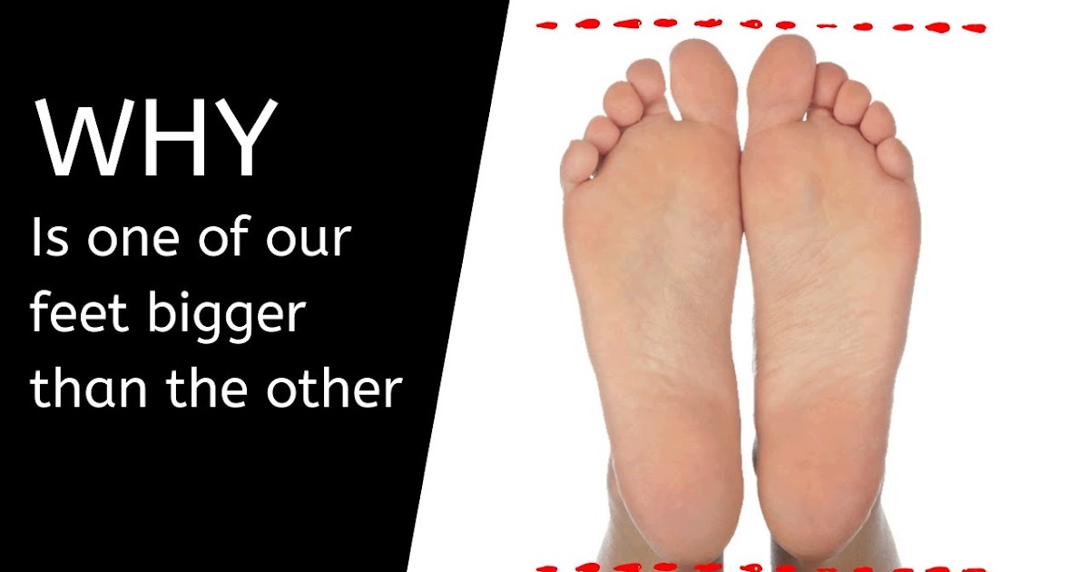 Why is One of Our Feet Bigger Than the Other?