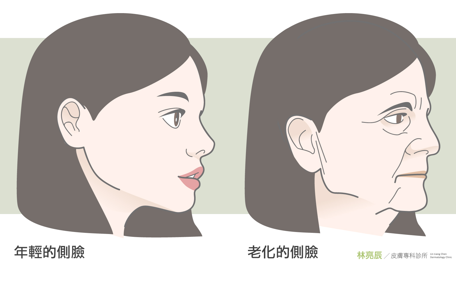 抗老醫美新竹舒顏萃童顏針液態拉皮新竹推薦電波拉皮鳳凰電波皮秒雷射m22彩衝光活氧泡泡電波水飛梭拉提緊實林亮辰皮膚科診所