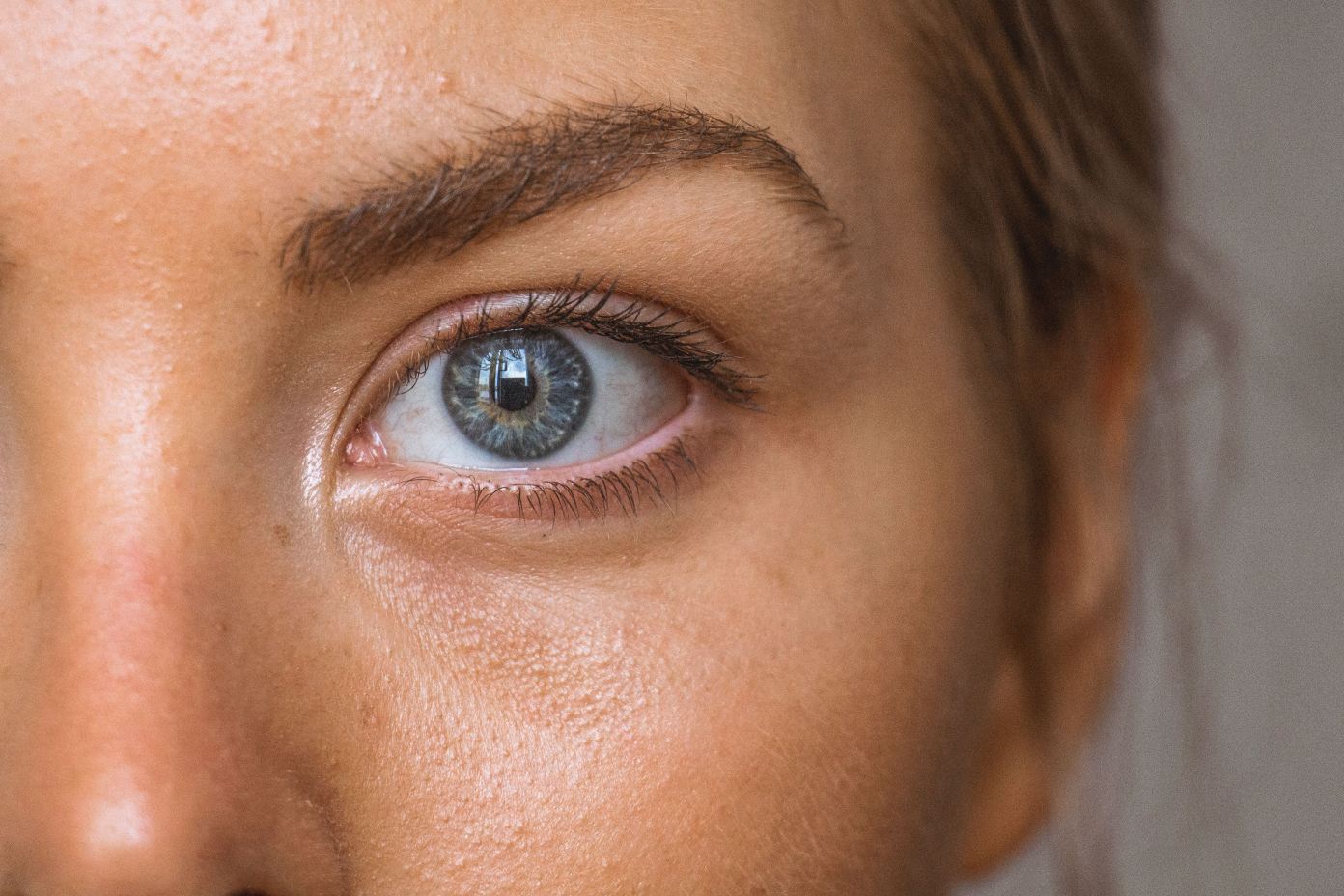 Try it! 4 Natural Ingredients to Dry Skin Around the Eyes