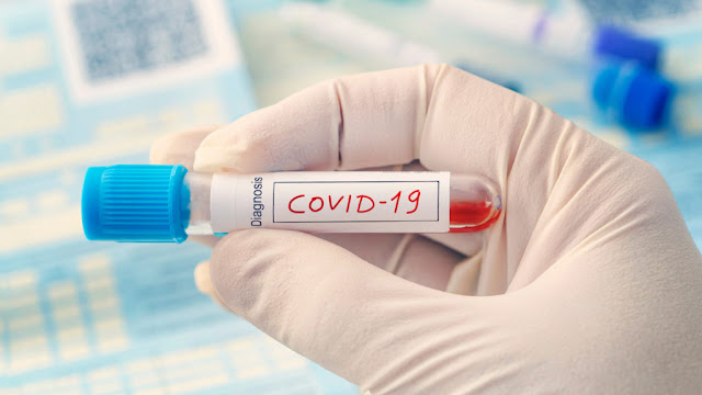 Roncador registra 4 novos casos de COVID-19 de ontem pra hoje!
