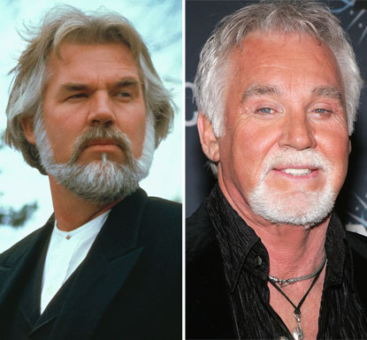 Kenny Rogers Plastic Surgery.