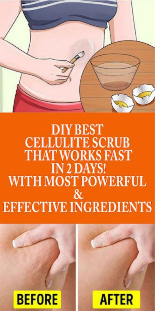 DIY Best Cellulite Scrub That Work Fast In 2 Days! With most Powerful