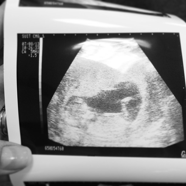 Countdown to Baby Hobgood Baby Hobgood 12 weeks!