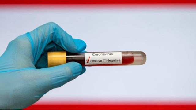 المهدية : تسجيل 08 إصابات جديدة بفيروس كورونا