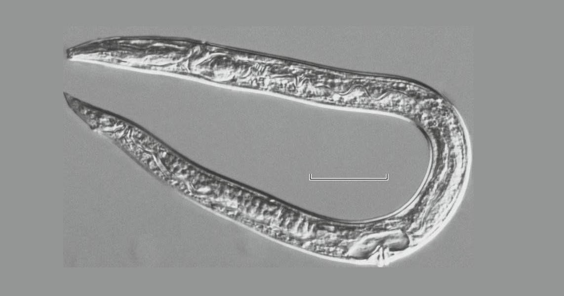 Worms Frozen for 42,000 Years in Siberian Permafrost Wriggle to Life