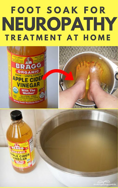 home remedies for nerve pain in feet home remedies for nerve pain in feet