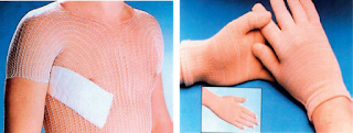 Tubular elasticated net garment and pressure gloves - Texpedia