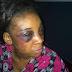 How I Was Battered By My Husband On Christmas Day - Woman Laments - Photos