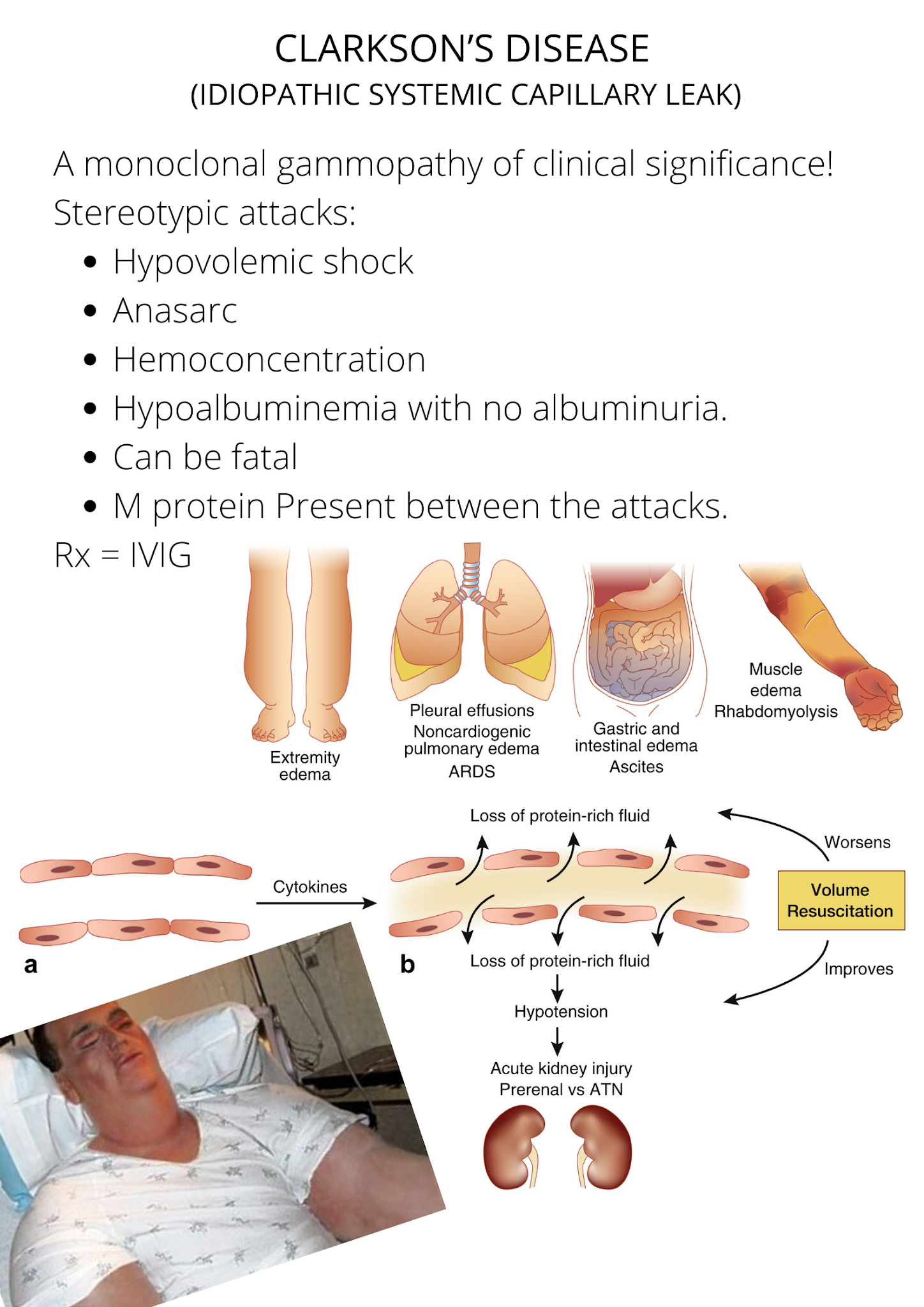 CLARKSON’S DISEASE