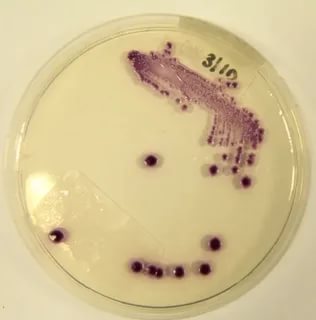 What You Must Know Before Using Candida Crusher